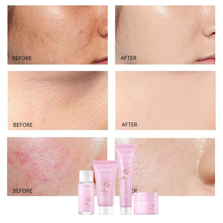 MOOYAM Sakura Brightening Skin Travel Kit high quality