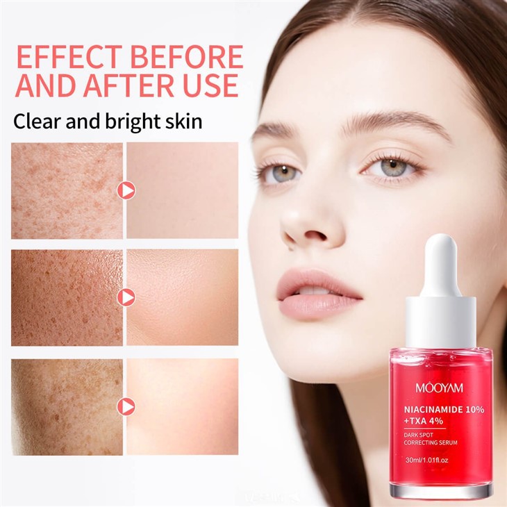OEM Niacinamide 10%+Txa 4% Dark Spot Correcting Whitening Serum factory
